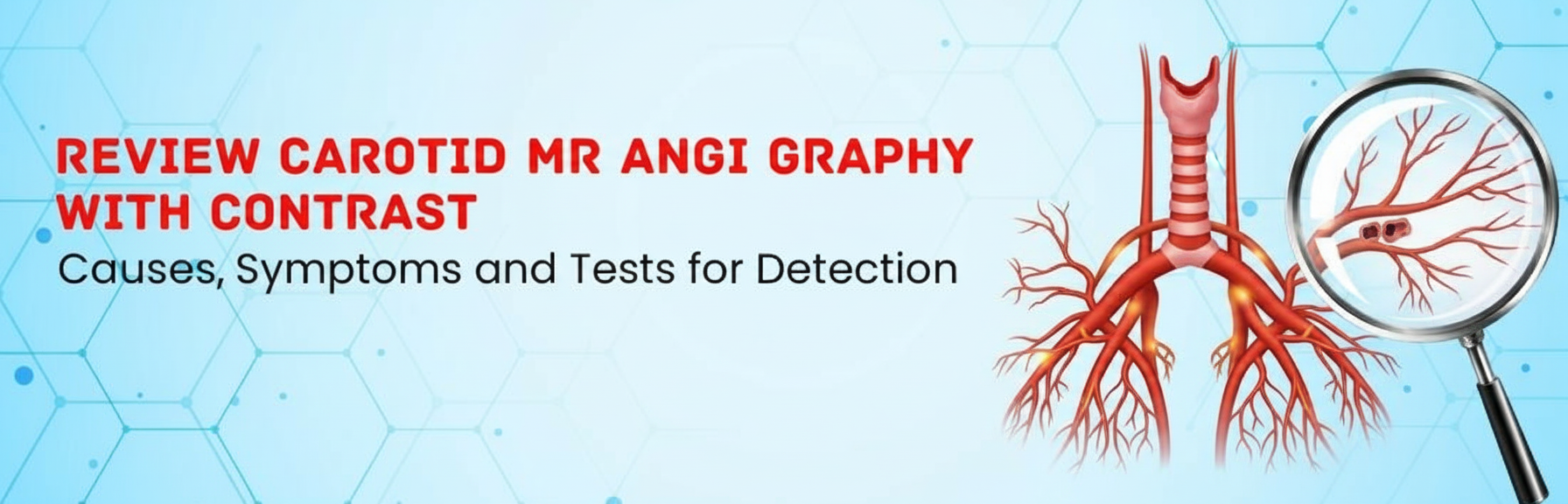 A Review Carotid MR Angiography with contrast